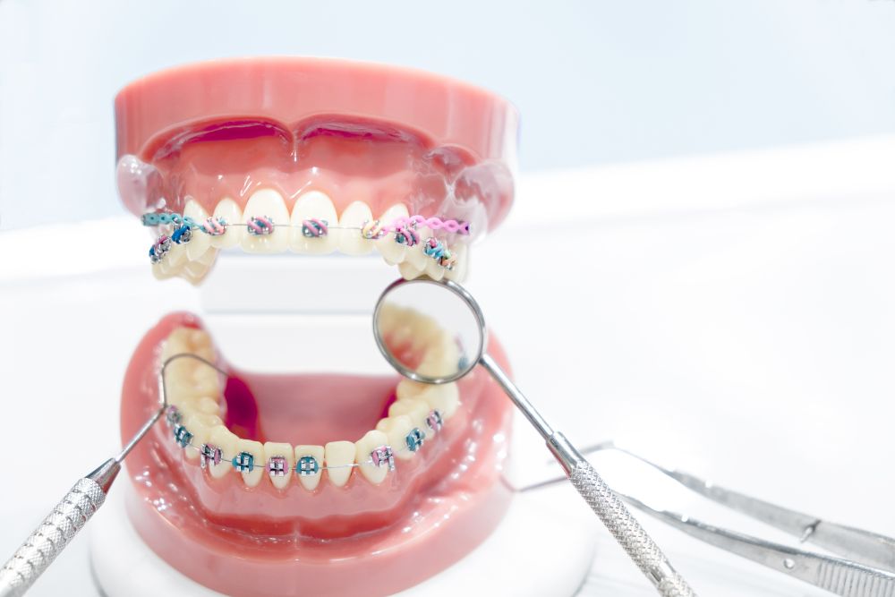 Ortodoncia en Zaragoza